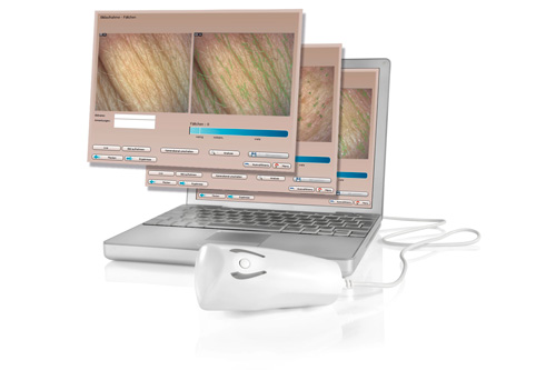 Derma-Visualizer-Monitor 300