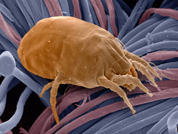 DUST-MITES