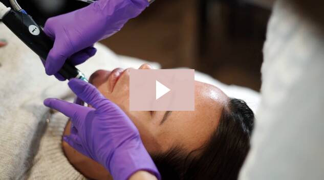 Emma Rose’s Skin Glows With HydraFacial